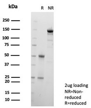 Galectin 3 Antibody