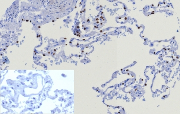 NKX2.1 Antibody / TTF-1
