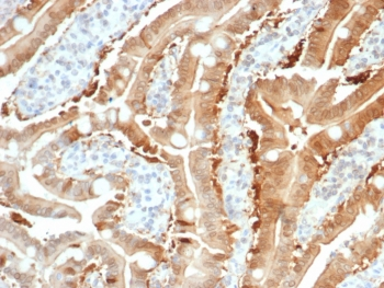 SULT1E1 Antibody / Estrogen Sulfotransferase