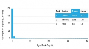 AAT Antibody / Alpha 1 Antitrypsin / SERPINA1