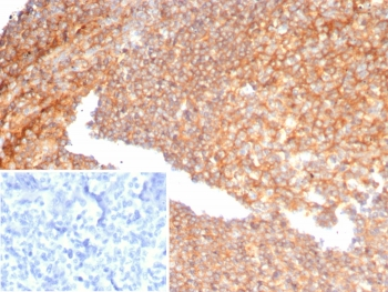 AAT Antibody / Alpha 1 Antitrypsin / SERPINA1