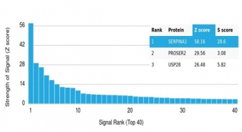 AAT Antibody / Alpha 1 Antitrypsin / SERPINA1