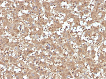 AAT Antibody / Alpha 1 Antitrypsin / SERPINA1