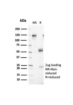Retinoblastoma Antibody / Rb1