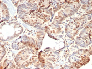 Recombinant Rb1 Antibody / Retinoblastoma