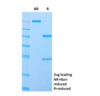 IgD Antibody / Heavy chain