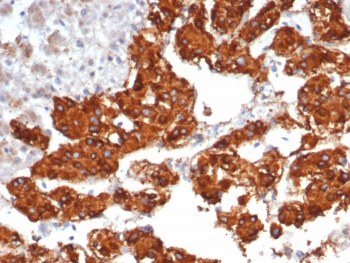 IL-31 Antibody