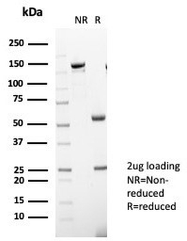 IL-31 Antibody