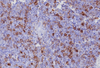 CD162 Antibody / P selectin glycoprotein ligand 1 / PSGL-1