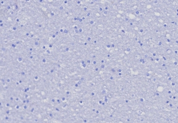 CD162 Antibody / P selectin glycoprotein ligand 1 / PSGL-1