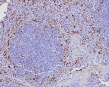 CD162 Antibody / P selectin glycoprotein ligand 1 / PSGL-1