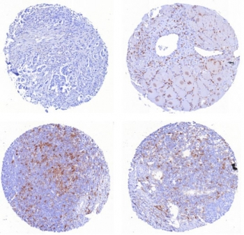 CD162 Antibody / P selectin glycoprotein ligand 1 / PSGL-1