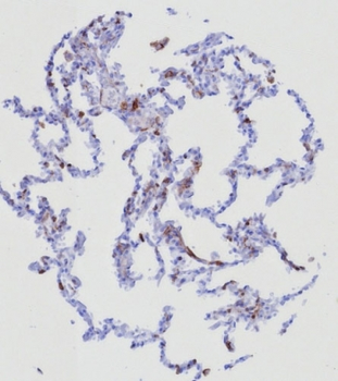 CD162 Antibody / P selectin glycoprotein ligand 1 / PSGL-1