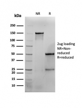 Interferon gamma Antibody / IFNG