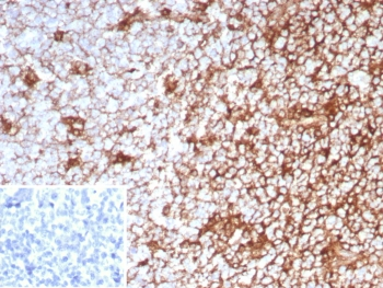 Recombinant CD63 Antibody / LAMP-3