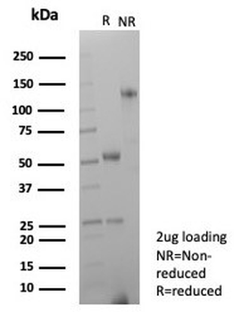 Recombinant CD63 Antibody / LAMP-3