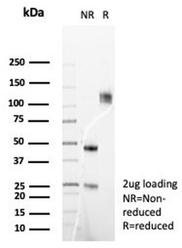 FGF-23 Antibody / Fibroblast Growth Factor 23