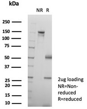 Keratin 6 Antibody / Cytokeratin 6