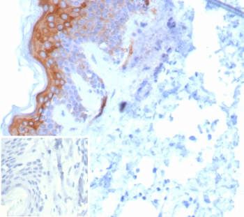 Keratin 6 Antibody / Cytokeratin 6