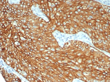 Keratin 6 Antibody / Cytokeratin 6