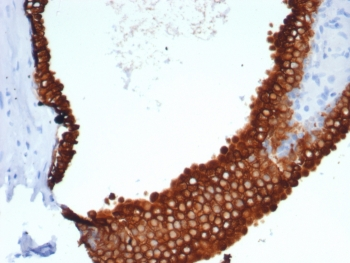Recombinant KRT18 Antibody / Cytokeratin 18