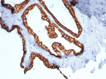 Recombinant KRT18 Antibody / Cytokeratin 18