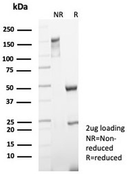Cytokeratin 5 Antibody / KRT5