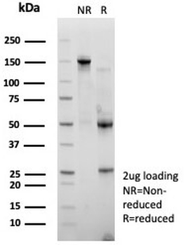 HDAC7 Antibody