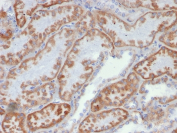 FGF23 Antibody / Fibroblast Growth Factor 23