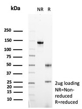 FGF23 Antibody / Fibroblast Growth Factor 23