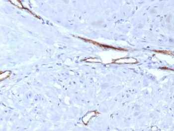von Willebrand Factor Antibody / vWF
