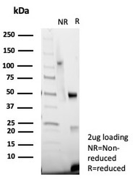 von Willebrand Factor Antibody / vWF