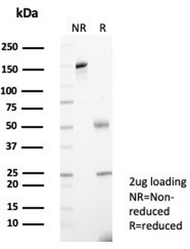 A2M Antibody / Alpha-2-Macroglobulin