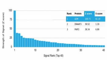 A2M Antibody / Alpha-2-Macroglobulin
