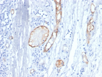 von Willebrand Factor Antibody