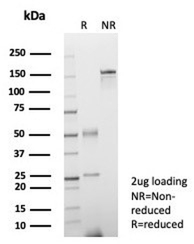 FGF-23 Antibody / Fibroblast Growth Factor 23