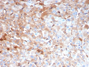 A2M Antibody / Alpha-2-Macroglobulin