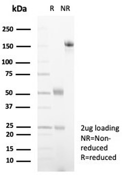 A2M Antibody / Alpha-2-Macroglobulin