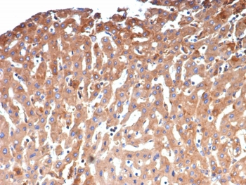 A2M Antibody / Alpha-2-Macroglobulin