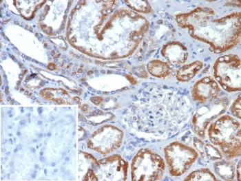 Fibroblast Growth Factor 23 Antibody / FGF23