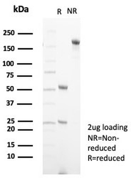 Fibroblast Growth Factor 23 Antibody / FGF23