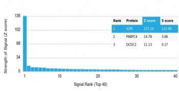 A2M Antibody / Alpha-2-Macroglobulin