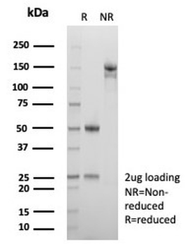 A2M Antibody / Alpha-2-Macroglobulin