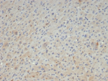 A2M Antibody / Alpha-2-Macroglobulin