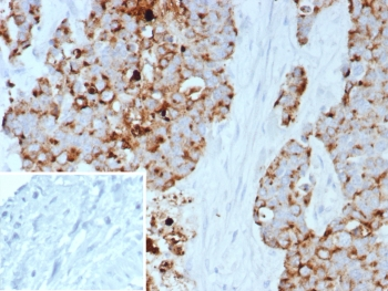GPRC5A Antibody / Retinoic acid-induced protein 3 / PEIG-1