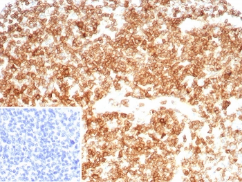 CD27 Antibody