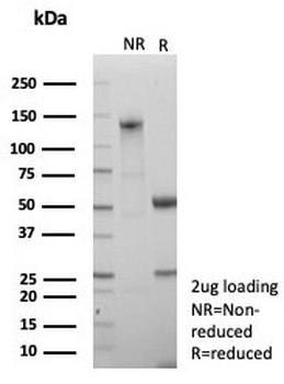 NSE Gamma Antibody / Neuron Specific Enolase / ENO2