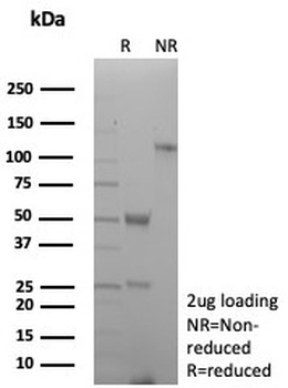 CD27 Antibody