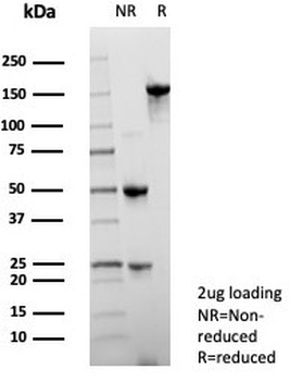 NSE Antibody