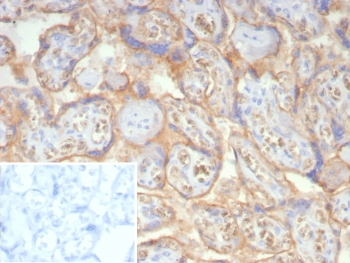 NSE Antibody